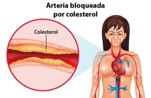 Colesterol 2